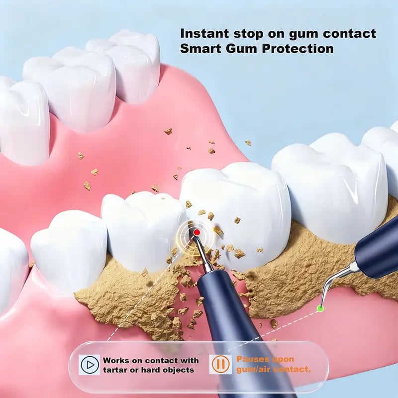 Electric Toothbrush - 🦷 Effectively removes plaque, tartar and stains Prevents cavities, bad breath and gum disease For home use