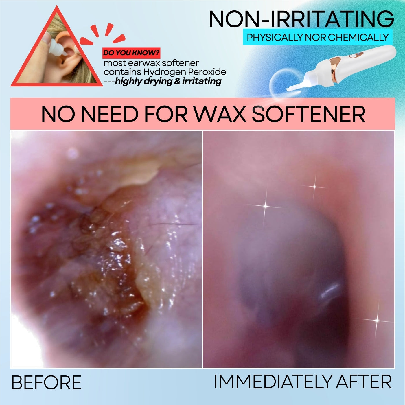 Safe & Painless Ear Cleaning for the Whole Family