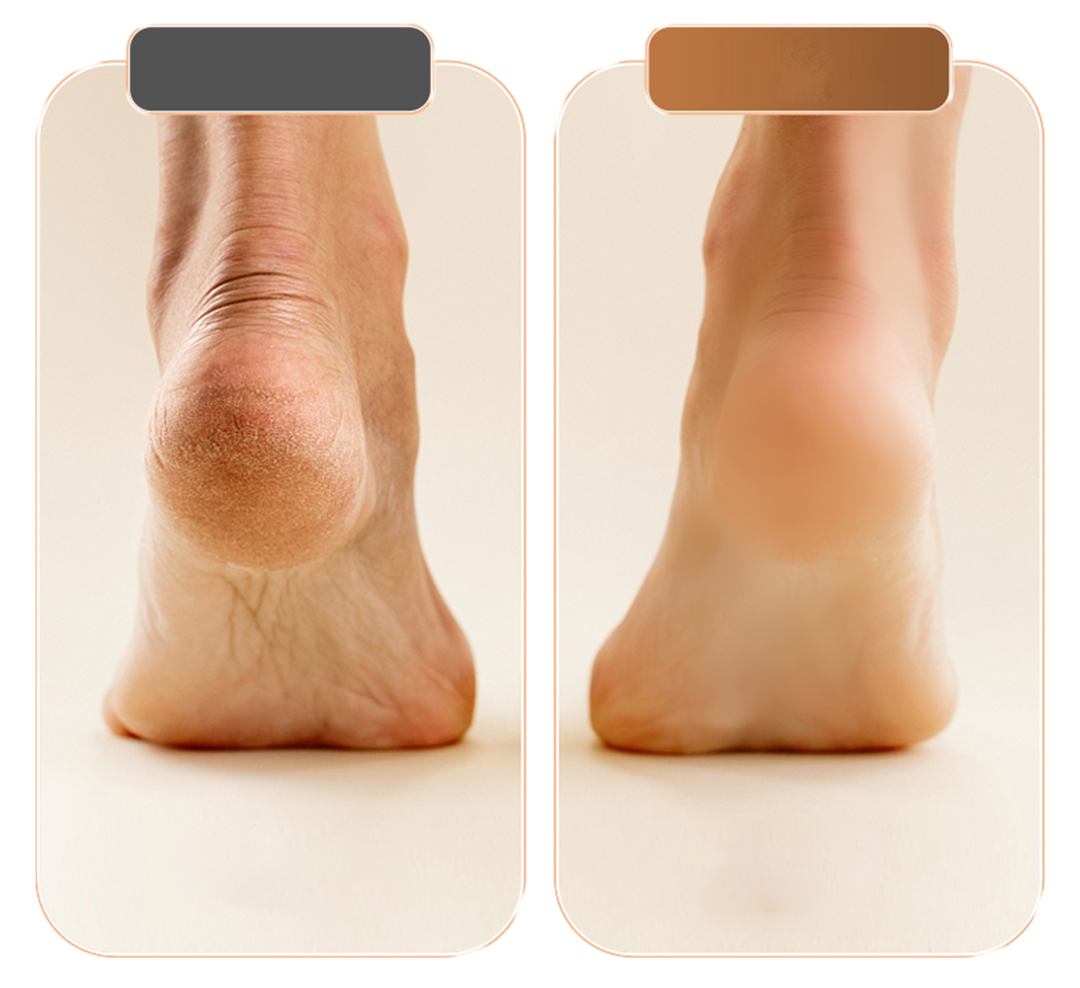 Spa-Quality Foot Care