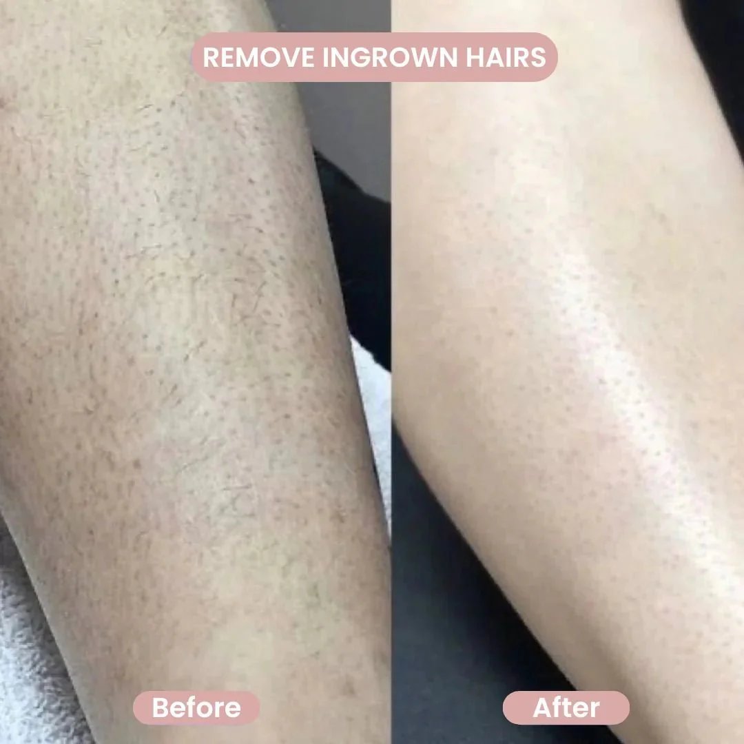 Glide to Silky Smooth Confidence Instantly