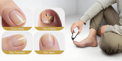 Long Handle Nail Clippers