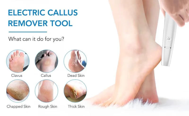 Exclusive Offer🎉 - Electric Feet Callus Remover