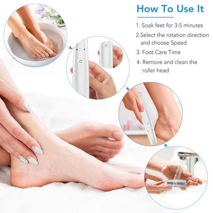 Exclusive Offer🎉 - Electric Feet Callus Remover