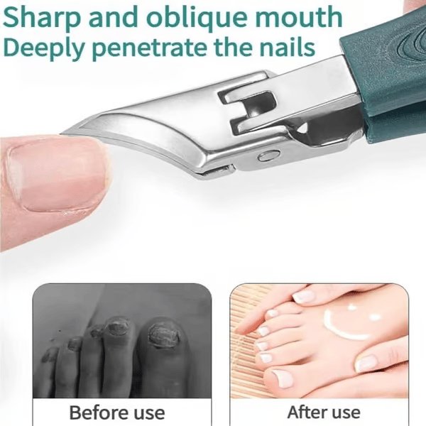 Eagle Beak Nail Clipper Set (With Filer and Nail Remover)